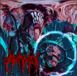 Fetuxion : Rectorenal Cranium Perfusion